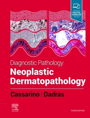 Patología Diagnóstica: Dermatopatología Neoplásica - Diagnostic Pathology: Neoplastic Dermatopathology