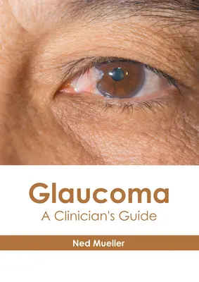 Glaucoma: Guía del clínico - Glaucoma: A Clinician's Guide