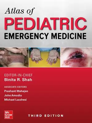 Atlas de urgencias pediátricas, tercera edición - Atlas of Pediatric Emergency Medicine, Third Edition