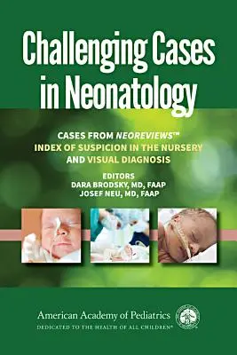 Casos difíciles en neonatología: Casos de Neoreviews 'Índice de sospecha en la guardería' y 'Diagnóstico visual' - Challenging Cases in Neonatology: Cases from Neoreviews 'Index of Suspicion in the Nursery' and 'Visual Diagnosis'