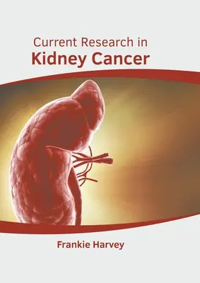 Investigación actual sobre el cáncer de riñón - Current Research in Kidney Cancer