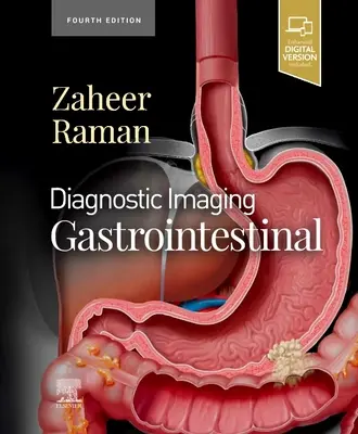 Diagnóstico por imagen: Gastrointestinal - Diagnostic Imaging: Gastrointestinal