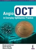 Angio-OCT en la Práctica Oftalmológica Diaria - Angio Oct in Everyday Ophthalmic Practice