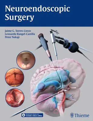 Cirugía neuroendoscópica - Neuroendoscopic Surgery