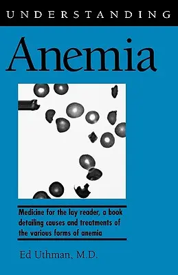 Entender la anemia - Understanding Anemia