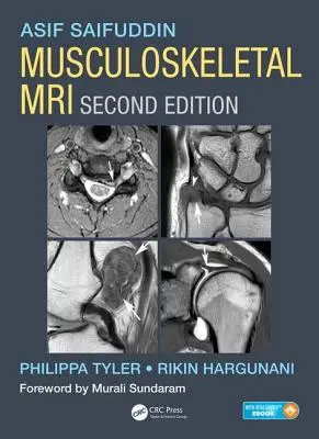 Resonancia magnética musculoesquelética - Musculoskeletal MRI