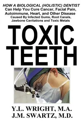 Dientes tóxicos: Cómo un Dentista Biológico (Holístico) Puede Ayudarle a Curar el Cáncer, el Dolor Facial, las Enfermedades Autoinmunes, Cardíacas y Otras Enfermedades Causadas - Toxic Teeth: How a Biological (Holistic) Dentist Can Help You Cure Cancer, Facial Pain, Autoimmune, Heart, and Other Disease Caused