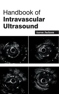 Manual de ecografía intravascular - Handbook of Intravascular Ultrasound