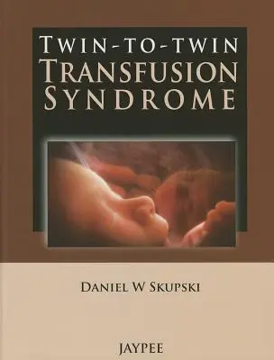 Síndrome de transfusión de gemelo a gemelo - Twin-To-Twin Transfusion Syndrome