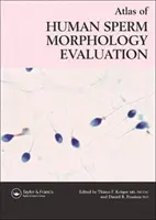 Atlas de evaluación de la morfología del esperma humano - Atlas of Human Sperm Morphology Evaluation