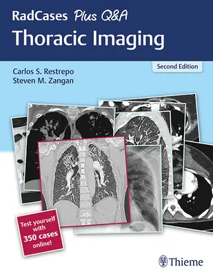 Radcases Plus Q&A Thoracic Imaging