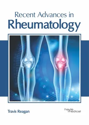 Avances recientes en reumatología - Recent Advances in Rheumatology