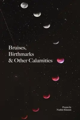 Magulladuras, marcas de nacimiento y otras calamidades - Bruises, Birthmarks & Other Calamities