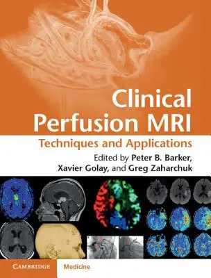 Resonancia magnética de perfusión clínica: Técnicas y aplicaciones - Clinical Perfusion MRI: Techniques and Applications