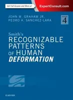 Patrones reconocibles de deformación humana de Smith - Smith's Recognizable Patterns of Human Deformation