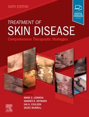 Tratamiento de las enfermedades cutáneas: Estrategias terapéuticas integrales - Treatment of Skin Disease: Comprehensive Therapeutic Strategies