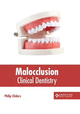 Maloclusión: Odontología clínica - Malocclusion: Clinical Dentistry