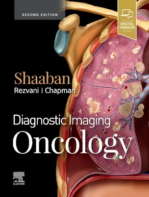 Diagnóstico por imagen: Oncología - Diagnostic Imaging: Oncology