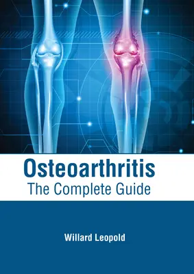 Osteoartritis: La guía completa - Osteoarthritis: The Complete Guide