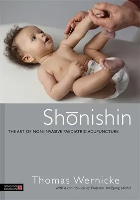 Shonishin: El arte de la acupuntura pediátrica no invasiva - Shonishin: The Art of Non-Invasive Paediatric Acupuncture