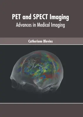 Pet and Spect Imaging: Avances en imagen médica - Pet and Spect Imaging: Advances in Medical Imaging