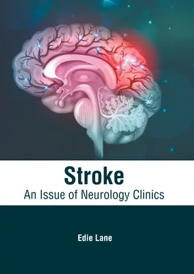 Stroke: Un número de Neurology Clinics - Stroke: An Issue of Neurology Clinics