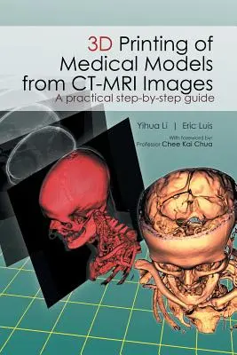 Impresión 3D de modelos médicos a partir de imágenes de TC-RM: Guía práctica paso a paso - 3D Printing of Medical Models from CT-MRI Images: A Practical step-by-step guide
