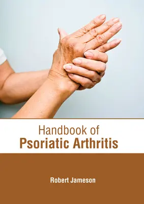 Manual de artritis psoriásica - Handbook of Psoriatic Arthritis