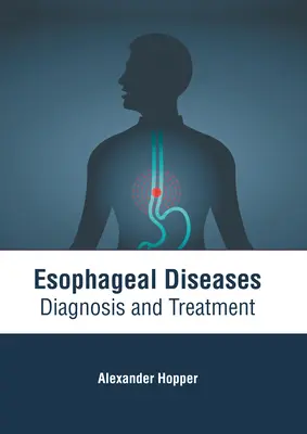 Enfermedades esofágicas: Diagnóstico y tratamiento - Esophageal Diseases: Diagnosis and Treatment