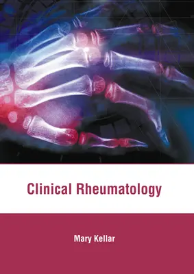 Reumatología clínica - Clinical Rheumatology