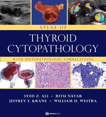 Atlas de citopatología tiroidea: Con Correlaciones Histopatológicas - Atlas of Thyroid Cytopathology: With Histopathologic Correlations
