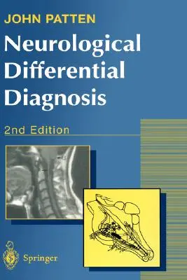 Diagnóstico neurológico diferencial - Neurological Differential Diagnosis