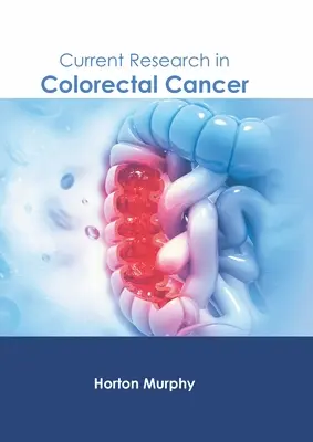 Investigación actual sobre el cáncer colorrectal - Current Research in Colorectal Cancer