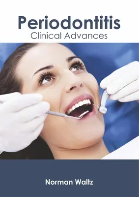 Periodontitis: Avances clínicos - Periodontitis: Clinical Advances