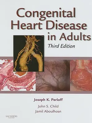 Cardiopatías congénitas del adulto - Congenital Heart Disease in Adults