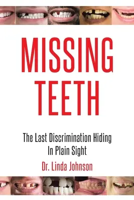 Dientes que faltan: La última discriminación oculta a plena vista - Missing Teeth: The Last Discrimination Hiding in Plain Sight