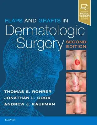 Colgajos e injertos en cirugía dermatológica - Flaps and Grafts in Dermatologic Surgery