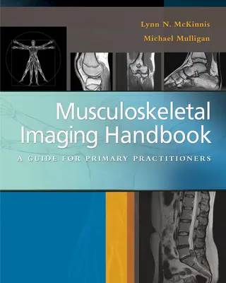 Manual de diagnóstico por imagen musculoesquelético: Guía para médicos de atención primaria - Musculoskeletal Imaging Handbook: A Guide for Primary Practitioners