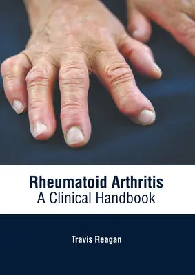 Artritis reumatoide: Manual clínico - Rheumatoid Arthritis: A Clinical Handbook