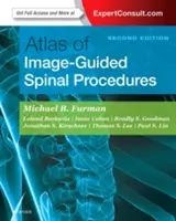 Atlas de procedimientos espinales guiados por la imagen - Atlas of Image-Guided Spinal Procedures