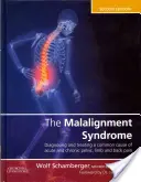 El síndrome de la mala alineación: Diagnóstico y tratamiento de los dolores comunes de pelvis y espalda - The Malalignment Syndrome: Diagnosis and Treatment of Common Pelvic and Back Pain