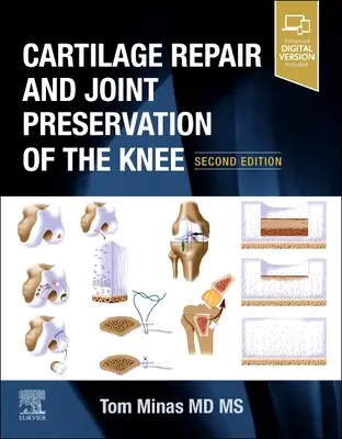 Reparación del cartílago y preservación articular de la rodilla - Cartilage Repair and Joint Preservation of the Knee