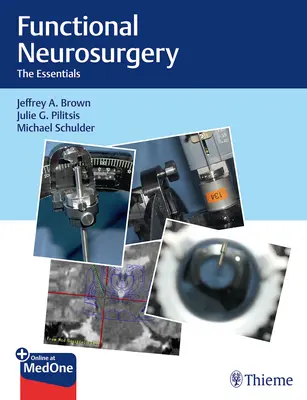 Neurocirugía funcional: Lo esencial - Functional Neurosurgery: The Essentials