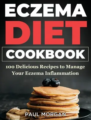 Eczema DIet Cookbook: 100 deliciosas recetas para controlar la inflamación del eczema - Eczema DIet Cookbook: 100 Delicious Recipes to Manage your Eczema Inflammation