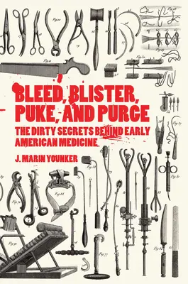 Sangrar, ampollarse, vomitar y purgarse: Los sucios secretos de la medicina americana primitiva - Bleed, Blister, Puke, and Purge: The Dirty Secrets Behind Early American Medicine