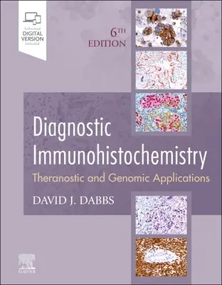 Inmunohistoquímica diagnóstica: Aplicaciones teranósticas y genómicas - Diagnostic Immunohistochemistry: Theranostic and Genomic Applications