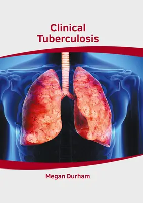 Tuberculosis clínica - Clinical Tuberculosis