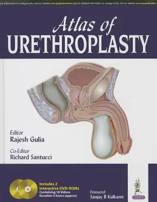 Atlas de uretroplastia - Atlas of Urethroplasty