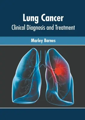 Cáncer de pulmón: Diagnóstico clínico y tratamiento - Lung Cancer: Clinical Diagnosis and Treatment