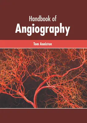 Manual de angiografía - Handbook of Angiography